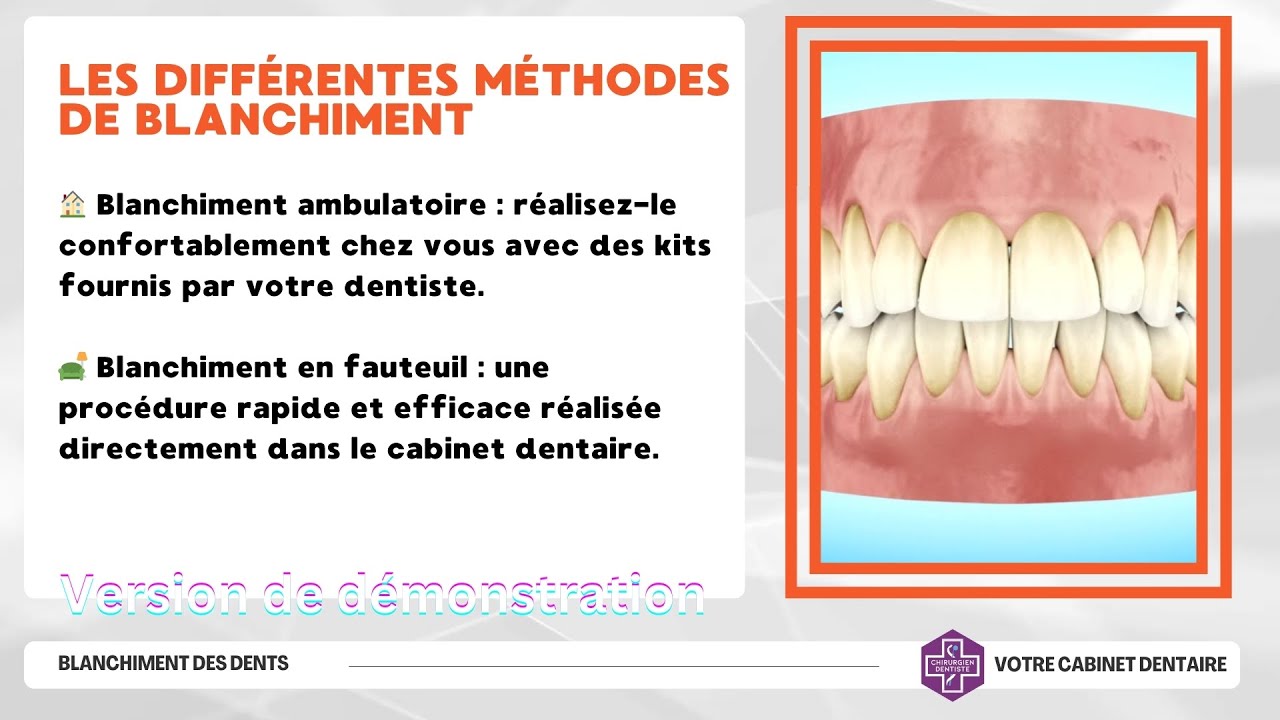 découvrez le blanchiment dentaire interne, une technique efficace pour éclaircir les dents dévitalisées. obtenez un sourire éclatant et rafraîchi tout en améliorant votre confiance en vous grâce à ce traitement professionnel adapté à vos besoins.
