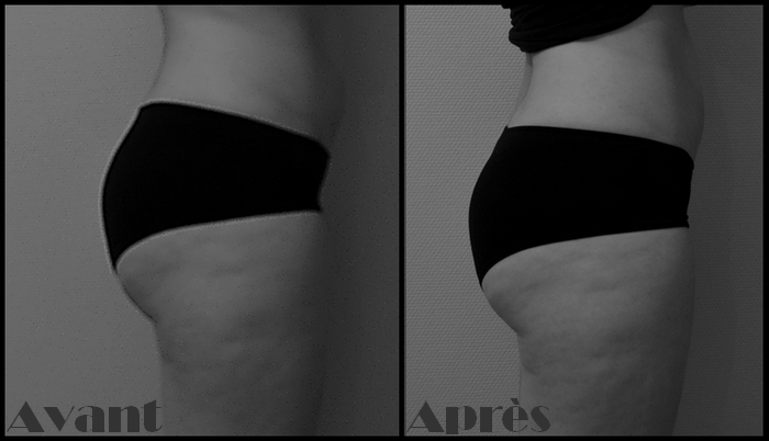 découvrez comment les squats peuvent transformer vos fessiers ! apprenez les bonnes techniques et suivez nos conseils pour maximiser vos résultats et sculpter votre silhouette. obtenez des fessiers fermes et bien dessinés grâce à une routine adaptée.